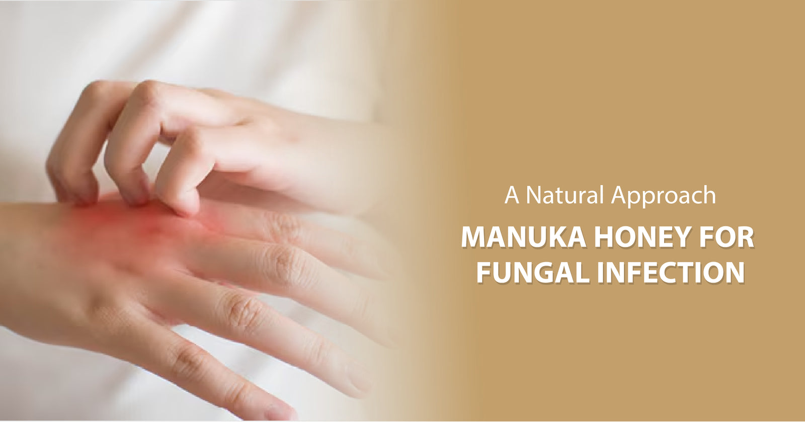 is manuka honey antifungal