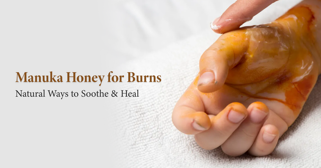 Manuka Honey for Burns: Natural Ways to Soothe and Heal