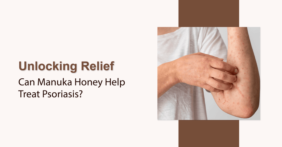 Unlocking Relief: Can Manuka Honey Help Treat Psoriasis?
