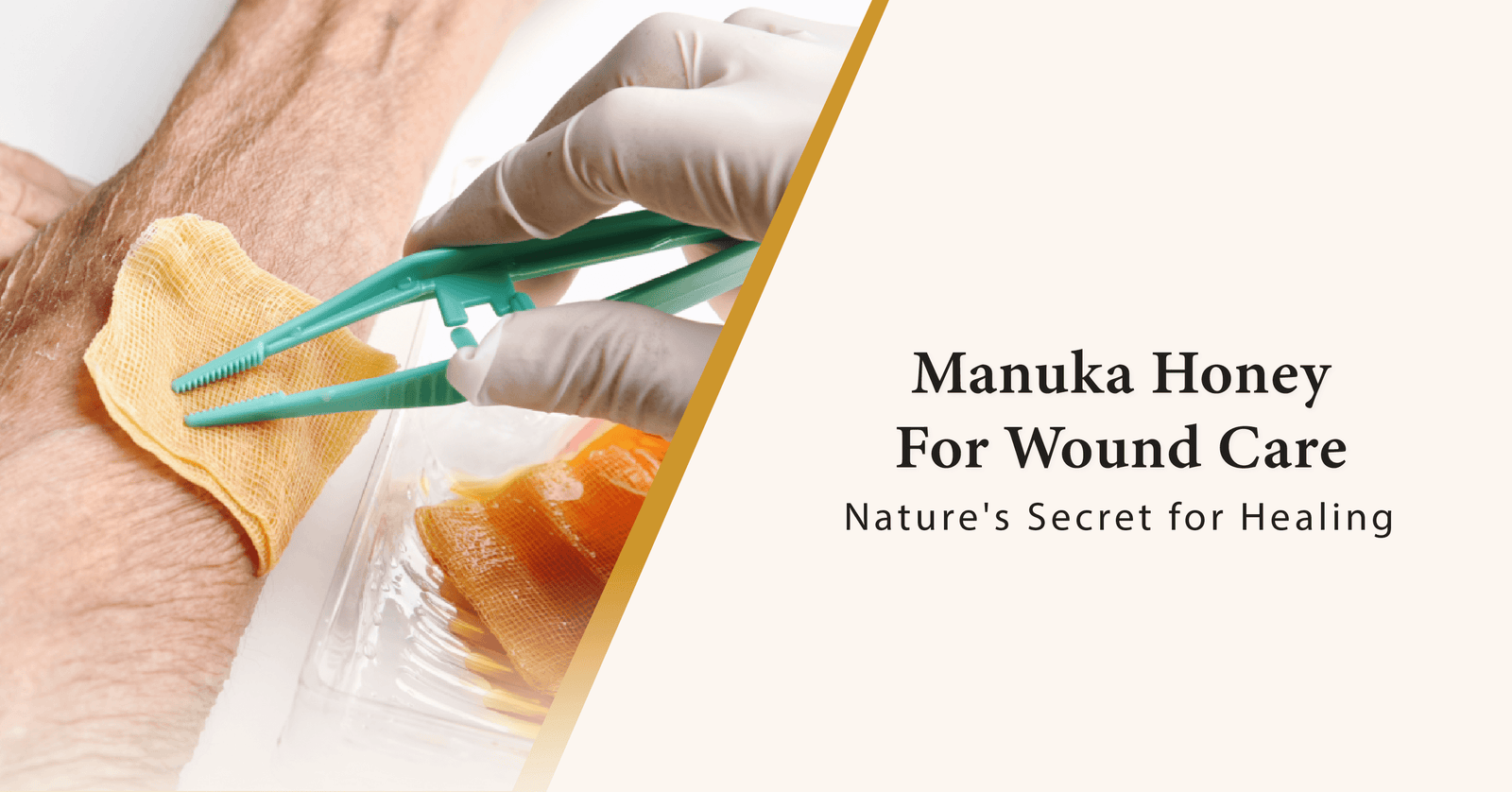 Manuka Honey for Wound Care