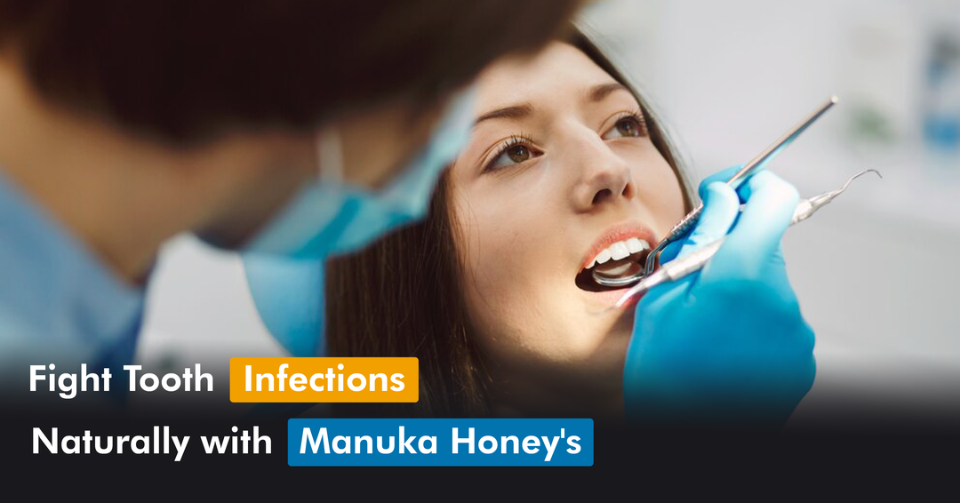 Fight Tooth Infections Naturally with Manuka Honey's Anti-Microbial Power