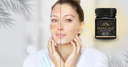 Manuka Honey for Dermatitis:Your Natural Skin Relief Guide
